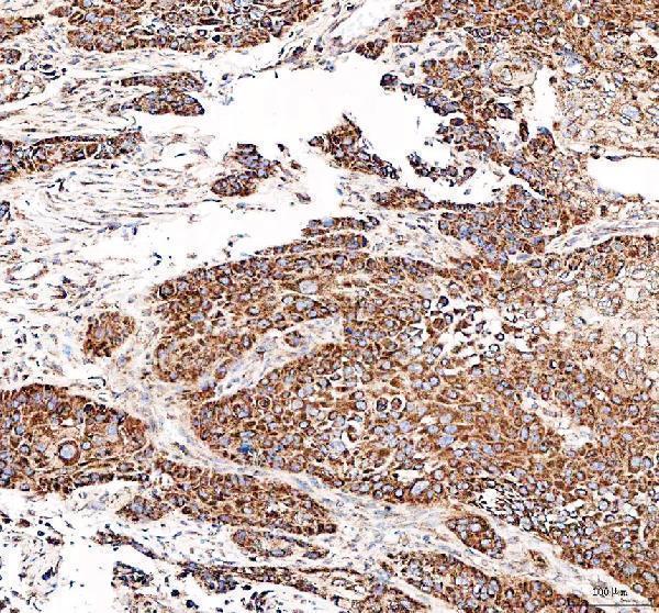 a05556 dynlt1 primary antibodies ihc testing 2_1