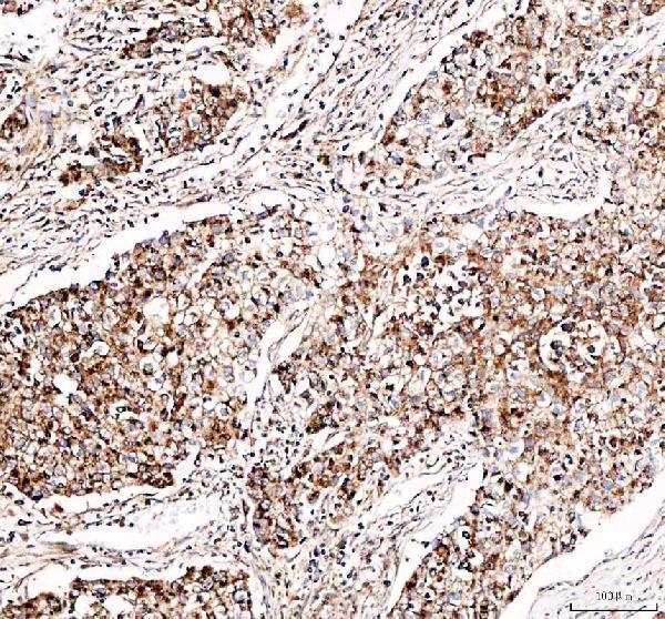 a05556 dynlt1 primary antibodies ihc testing 4_1
