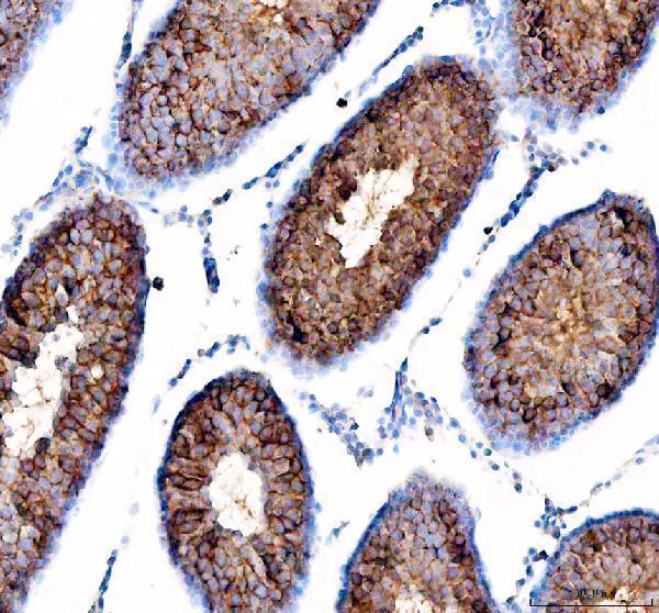 a05556 dynlt1 primary antibodies ihc testing 7