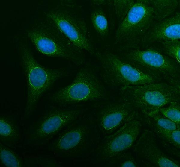 a05557 1 ethe1 primary antibodies if testing 1