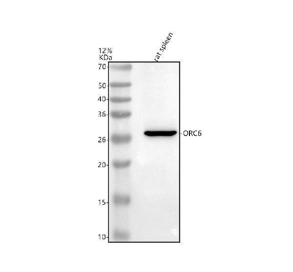 Western blot analysis of ORC6 using anti-ORC6 antibody (A05558-3)