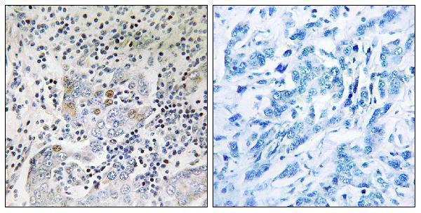 a05559 1 sesn1 primary antibodies ihc testing 1
