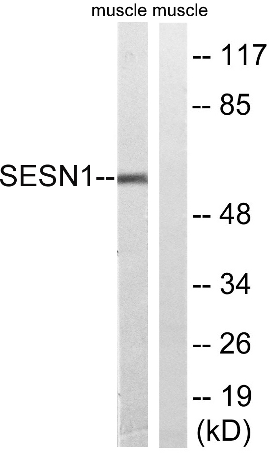 a05559 1 sesn1 primary antibodies wb testing 2