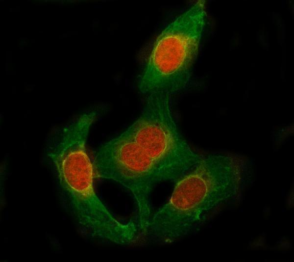  IF analysis of SESN1 using anti-SESN1 antibody (A05559-2) and anti-Beta Tubulin antibody (M01857-3)