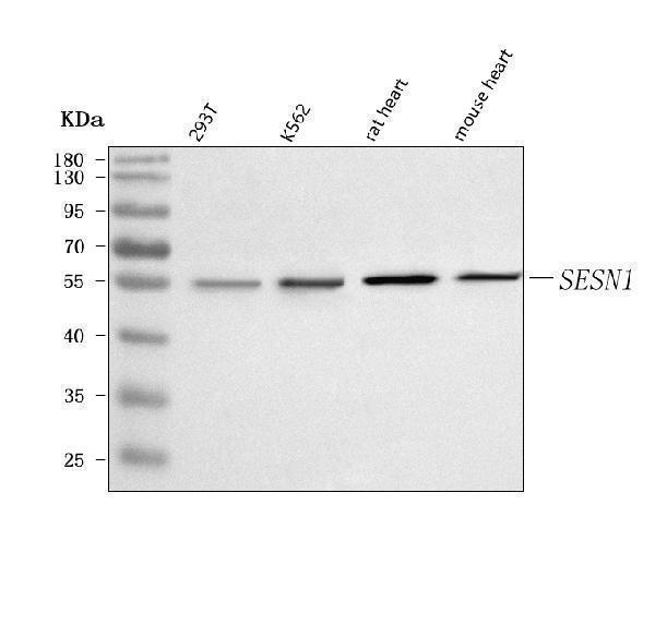  Western blot analysis of SESN1 using anti-SESN1 antibody (A05559-2)