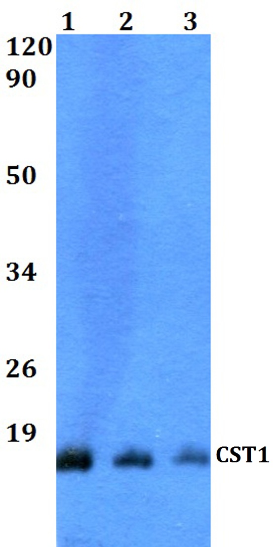 Western blot (WB) analysis of CST1 polyclonal antibody at 1:500 dilution
Lane1:HEK293T whole cell lysate
Lane2:sp2/0 whole cell lysate 
Lane3:PC12 whole cell lysate 