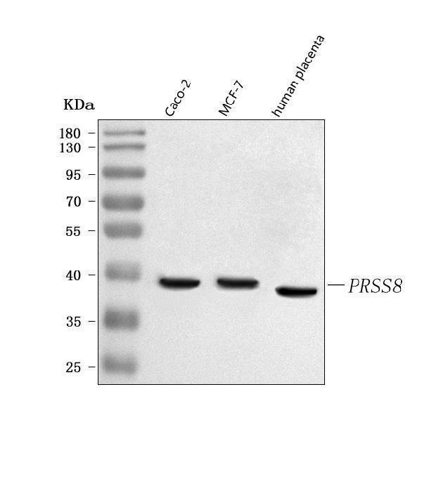  Western blot analysis of PRSS8 using anti-PRSS8 antibody (A05561-2)
