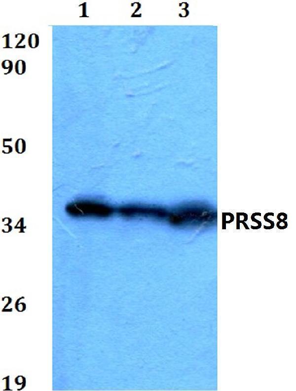 Western blot (WB) analysis of PRSS8 polyclonal antibody at 1:500 dilution
Lane1:HEK293T whole cell lysate
Lane2:Raw264