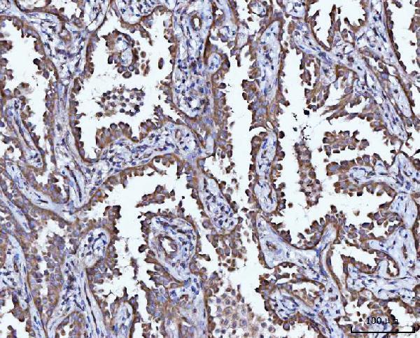  IHC analysis of CCL15 using anti-CCL15 antibody (A05563-1)