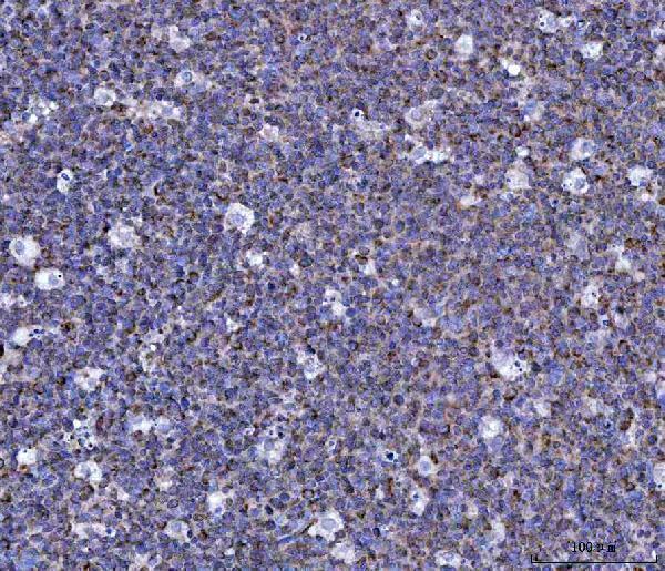  IHC analysis of CCL15 using anti-CCL15 antibody (A05563-1)