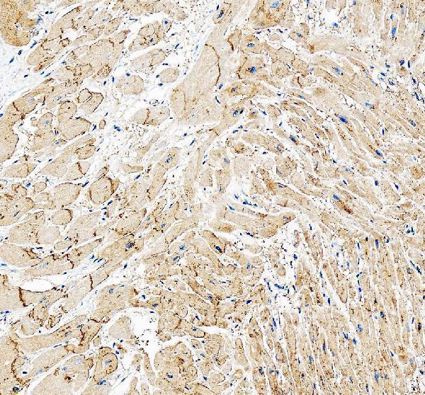 IHC analysis of GJA4 using anti-GJA4 antibody (A05569-1)