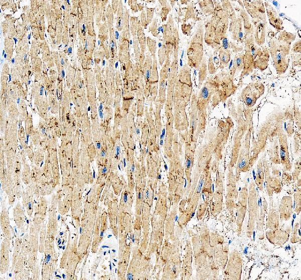 IHC analysis of GJA4 using anti-GJA4 antibody (A05569-1)
