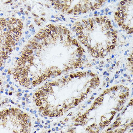 Immunohistochemistry of paraffin-embedded human colon using KIF22 antibody  at dilution of 1:100 