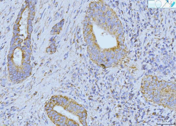 a05572 2 etfa primary antibodies ihc testing 3