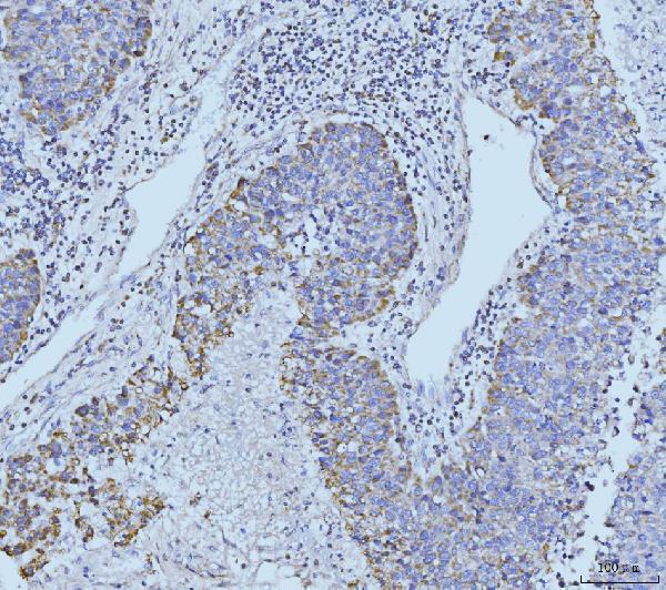 a05572 2 etfa primary antibodies ihc testing 5
