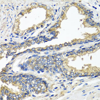 a05572 etfa primary antiboties ihc testing 2