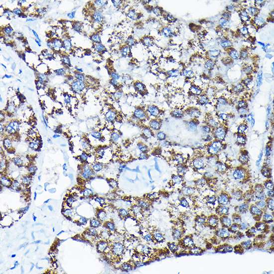 a05572 etfa primary antiboties ihc testing 4