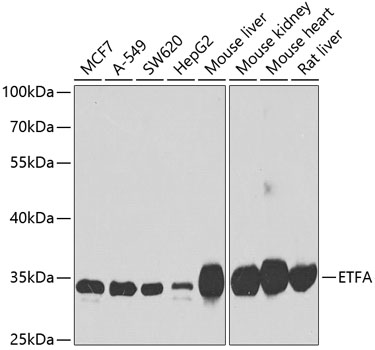 a05572 etfa primary antiboties wb testing 1