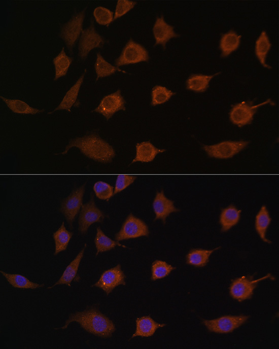 a05573 1 lsm1 primary antiboties if testing 2