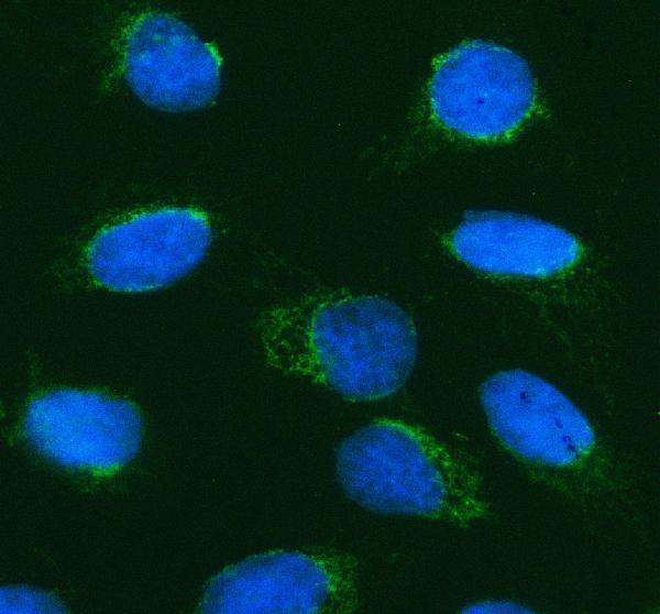 a05574 1 ptpre primary antibodies if testing 7