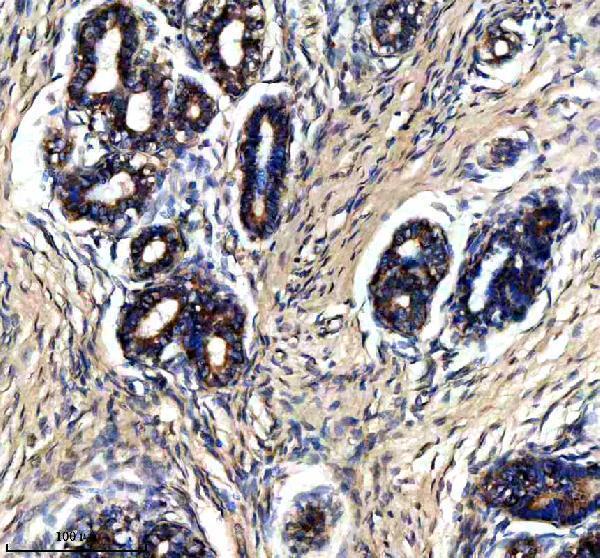  IHC analysis of PTPRE using anti-PTPRE antibody (A05574-1)