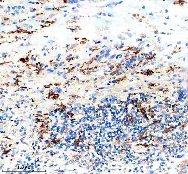 a05574 1 ptpre primary antibodies ihc testing 5