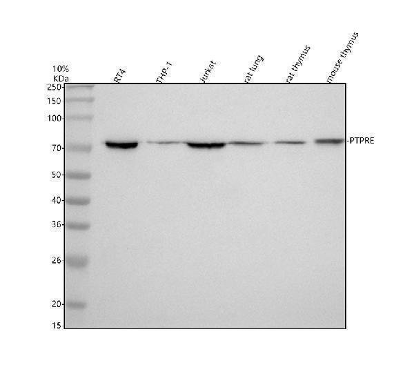  Western blot analysis of PTPRE using anti-PTPRE antibody (A05574-1)