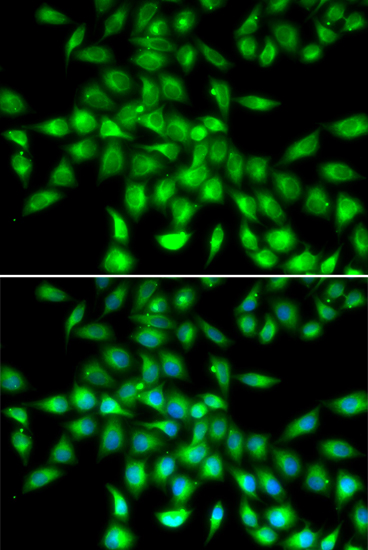 a05576 serpina10 primary antiboties if testing 1