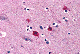 Immunohistochemistry of BOK in human brain tissue with BOK antibody at 5 μg/mL