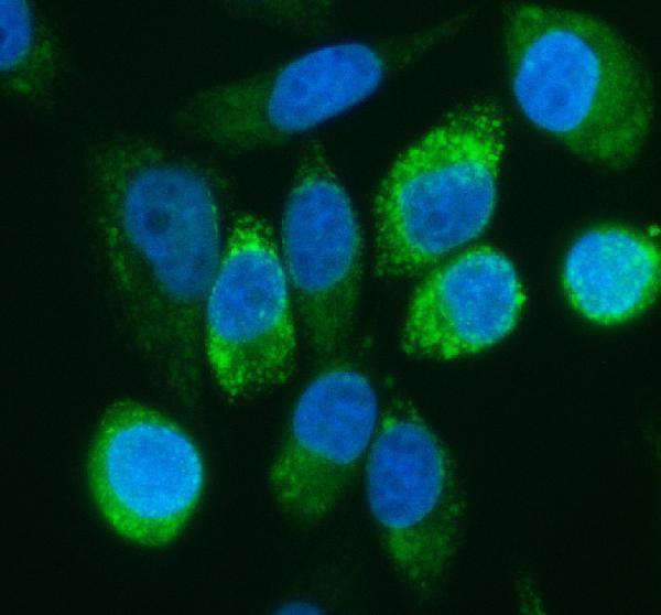 a05579 2 psph primary antibodies if testing 1