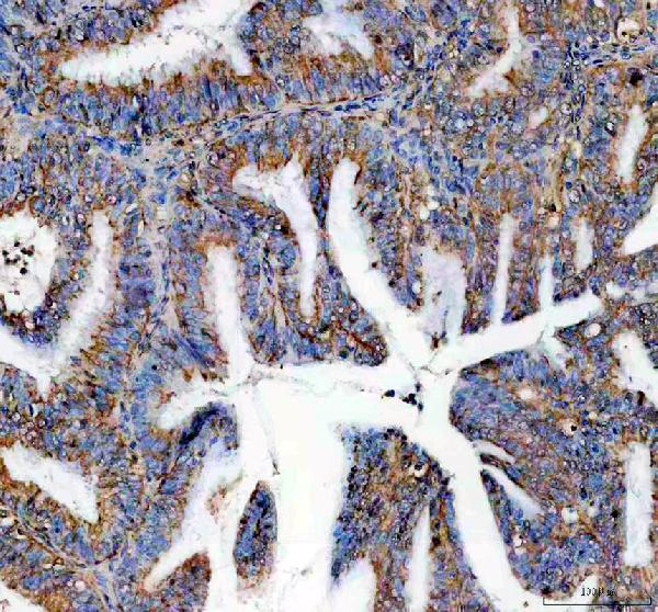 IHC analysis of PSPH using anti-PSPH antibody (A05579-2)