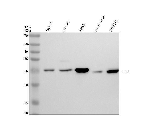 Western blot analysis of PSPH using anti-PSPH antibody (A05579-2)