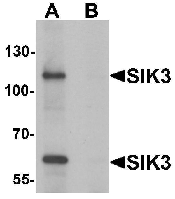 a05580 1 sik3 primary antibodies wb testing 1