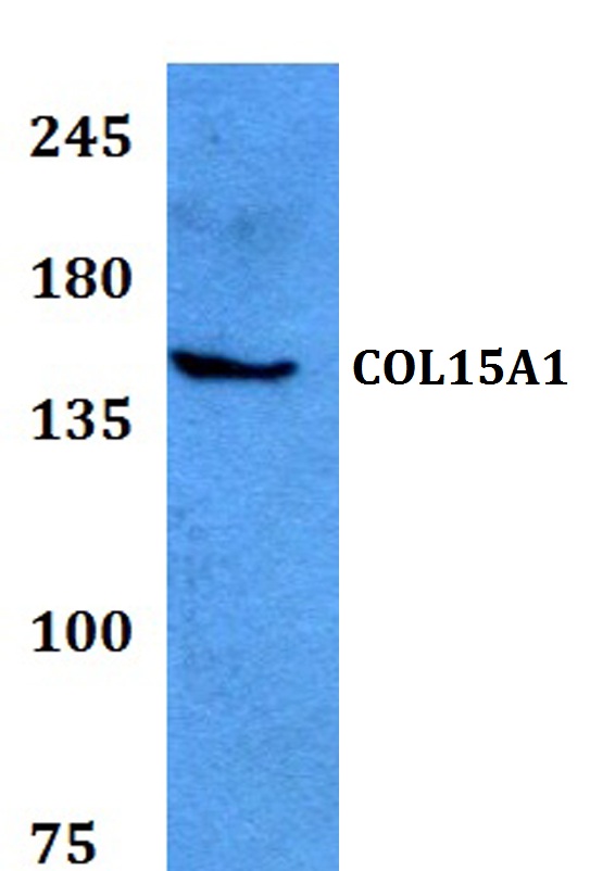 Western blot (WB) analysis of COL15A1 polyclonal antibody at 1:500 dilution
Lane1:HEK293T whole cell lysate