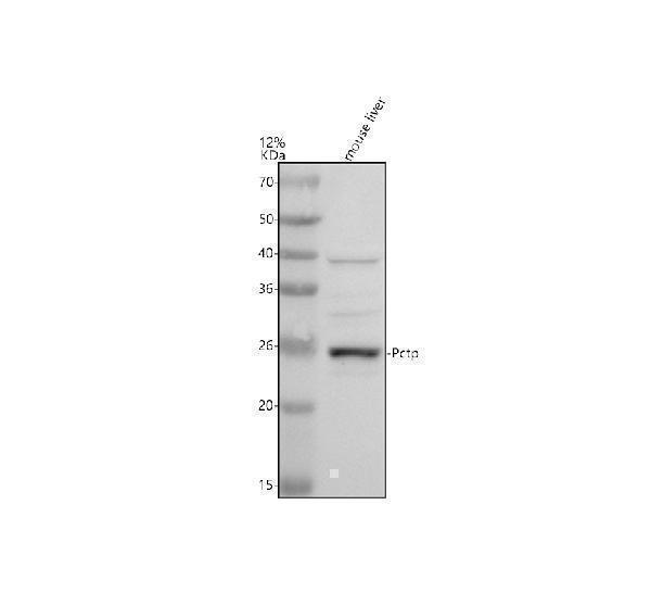 Western blot analysis of PCTP using anti-PCTP antibody (A05582-1)