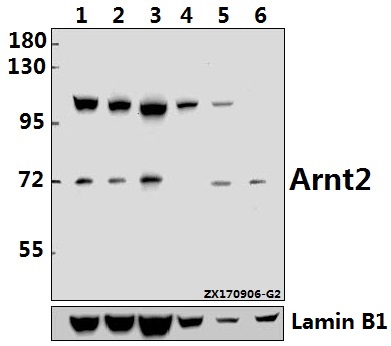 Western blot (WB) analysis of Arnt2 (M50) pAb at 1:500 dilution
Lane1:A549 whole cell lysate(40ug)
Lane2:MCF-7 whole cell lysate(40ug)
Lane3:HEK293T whole cell lysate(40ug)
Lane4:Hela whole cell lysate(40ug)
Lane5:H9C2 whole cell lysate(40ug)
Lane6:3T3-L1 whole cell lysate(40ug)