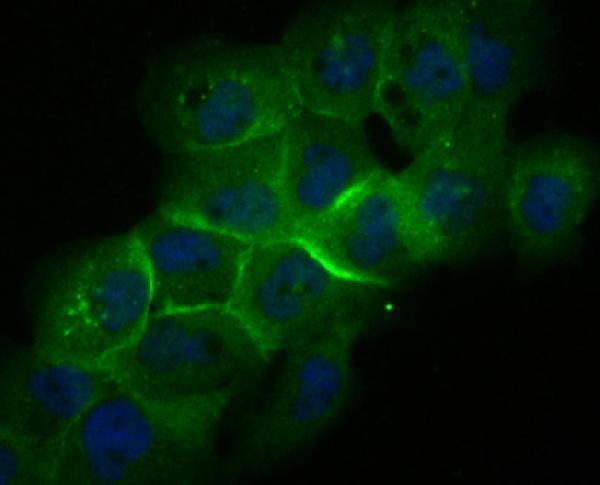 ICC staining Galectin 8 in A431 cells (green)