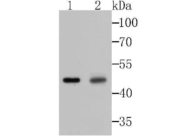 Western blot analysis of Galectin 8 on mouse testis and rat testis tissue lysates using anti-Galectin 8 antibody at 1/500 dilution