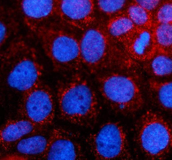 a05589 1 gpd2 primary antibodies if testing 1