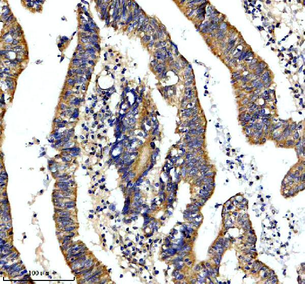 IHC analysis of GPD2 using anti-GPD2 antibody (A05589-1)