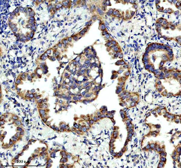 IHC analysis of GPD2 using anti-GPD2 antibody (A05589-1)