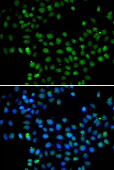 Immunofluorescence analysis of A549 cell using EAF2 antibody