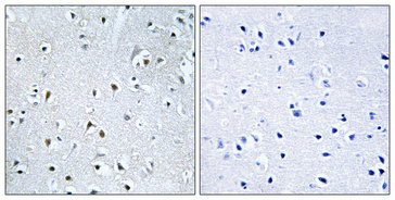 a05593 1 med13l primary antibodies ihc testing 1