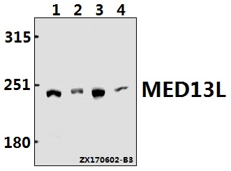 a05593 med13l primary antiboties wb testing 1
