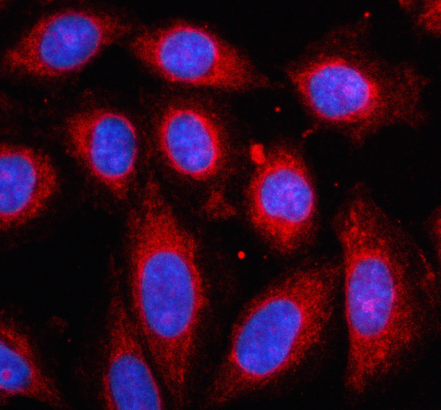 a05595 1 bckdhb primary antibodies if testing 1