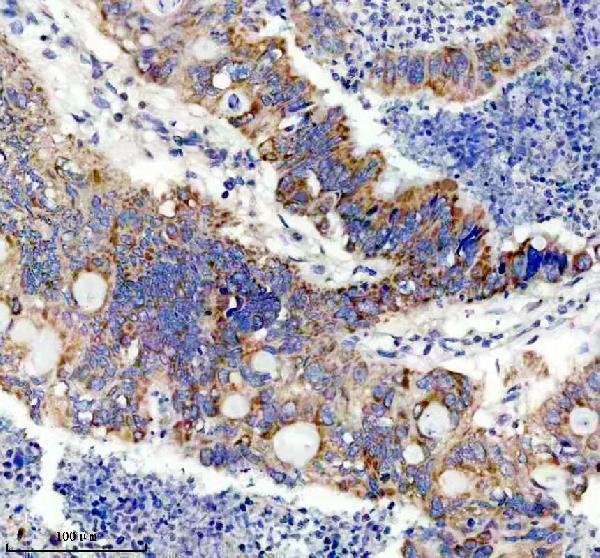 a05595 1 bckdhb primary antibodies ihc testing 1
