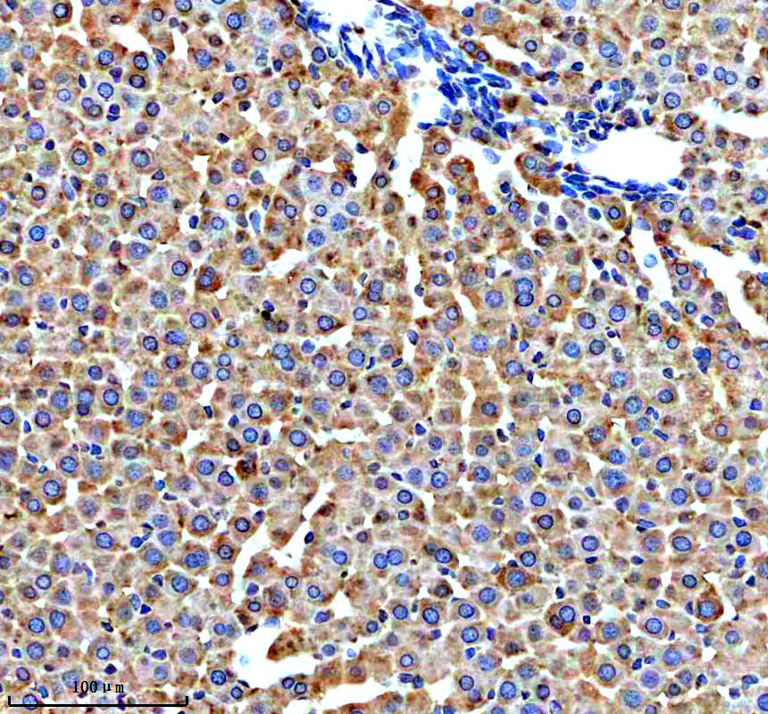 a05595 1 bckdhb primary antibodies ihc testing 2