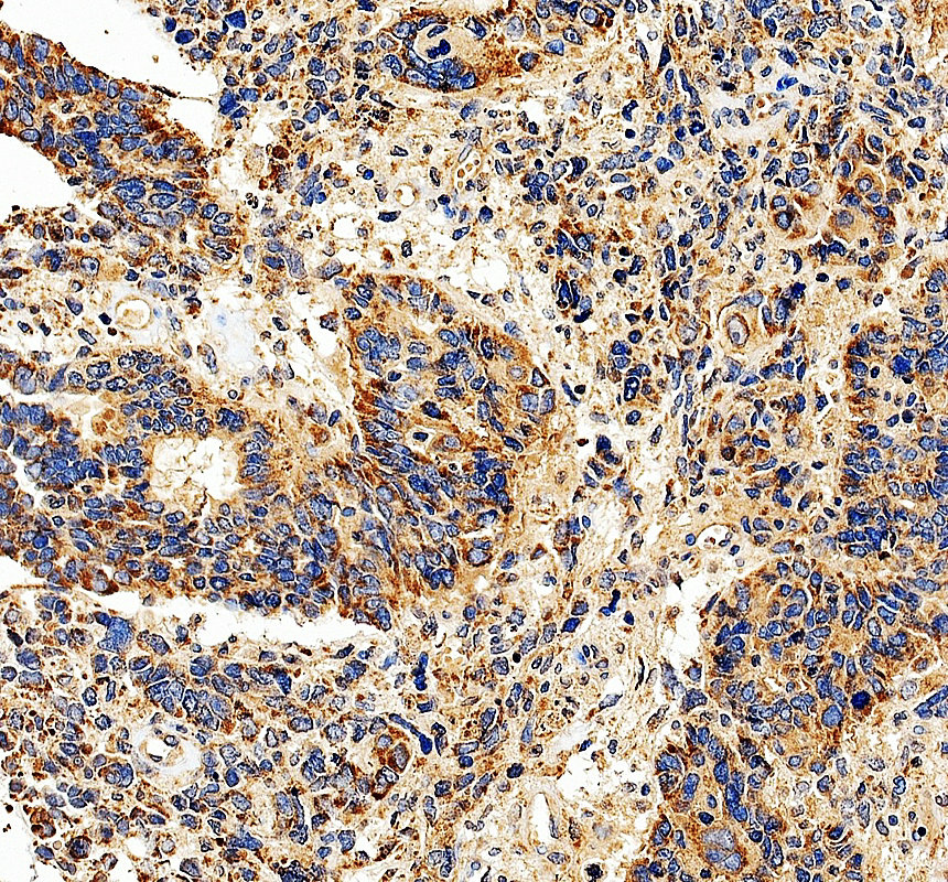 a05595 1 bckdhb primary antibodies ihc testing 3