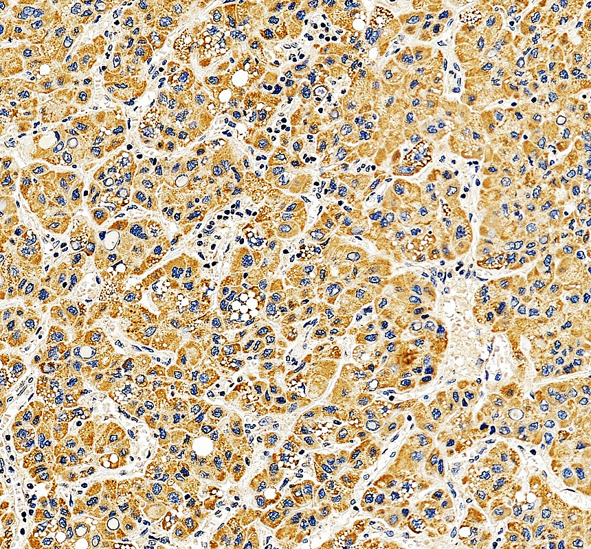 a05595 1 bckdhb primary antibodies ihc testing 4