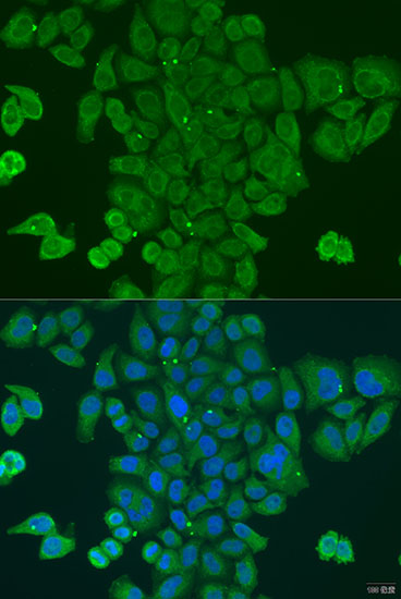a05597 dpm1 primary antiboties if testing 2